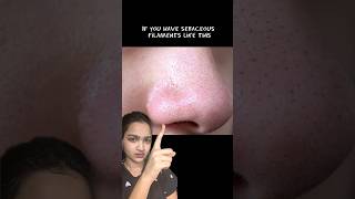 This remove sebaceous filaments on nose 😳 [upl. by Ernesto117]