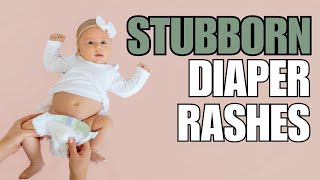 Pediatrician Explains Diaper Rash Advice Best Creams amp Prevention [upl. by Labannah533]