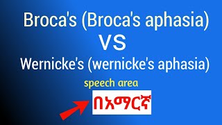 Brocas aphasia vs Wernickes aphasia Brocas vs Wernickes speech area in amharic በአማርኛ [upl. by Lorianne]