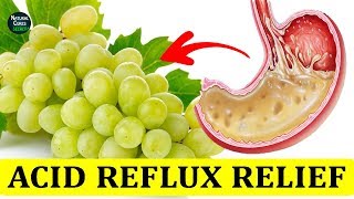 How To Treat Acid Reflux Fast Naturally  Heartburn Relief Instantly [upl. by Yroger]