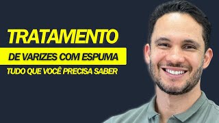 Tratamento de varizes com espuma  Tudo que você precisa saber varizes [upl. by Wing]