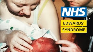 What its like to have a baby with Edwards syndrome  My Story  Chloe and Penelope  NHS [upl. by Alyl]