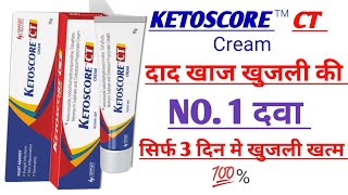 KETOSCORE CT Cream Ketoscore ct cream review Ketoscore ct cream uses in Hindi दाद खाज खुजली कि दवा [upl. by Podvin]