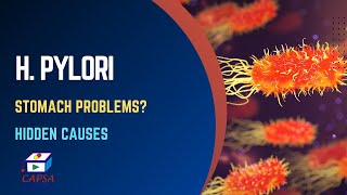 H pylori Infection Symptoms Causes Treatment amp Diet Tips for Gut Health [upl. by Ahsilam571]