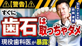 【暴露】気軽な歯石取りの決定的なリスクと全身への悪影響をプロが解説【歯科医】 [upl. by Gavra495]