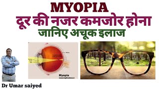 MYOPIA दूर की नजर कमजोर होना TREATMENT [upl. by Baylor543]