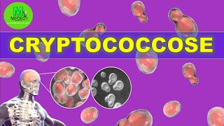 CRYPTOCOCCOSE  cours de mycologie médicale [upl. by Attekal]