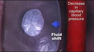 Capillary Blood Pressure quotCBPquot [upl. by Sophronia]