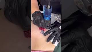 A Ocean Saline Tattoo Removal method [upl. by Coletta553]