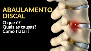 Abaulamento Discal  O que é Quais os sintomas Como tratar [upl. by Nylirak]