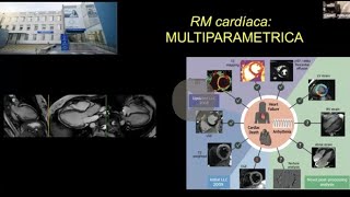 690 RM Cardiaca multiparamétrica [upl. by Eigram]