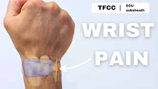 Wrist pain  TFCC  ECU subsheath rehab [upl. by Nnaihs256]