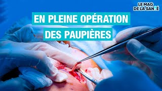 👁️ Une chirurgie pour remonter les PAUPIÈRES  Allo Docteurs [upl. by Yand]