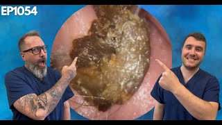 Removing Massive Ear Wax Blockages  EP1054 [upl. by Tsugua]