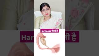 Types of Ovarian Cyst  Dr Soniya Singh  Book Your Appointment Now [upl. by Steep759]