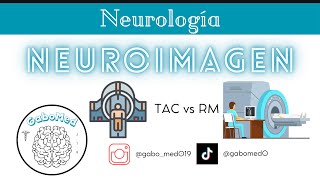 Neuroimagen  ¿Cómo Diferenciar Entre Una TAC Y Una RM [upl. by Nojid]