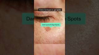 DERMATOUCH Bye Bye Pigmentation Cream reviewdarkspotsdermocosmeticspigmentationhyperpigmentation [upl. by Suzanne235]