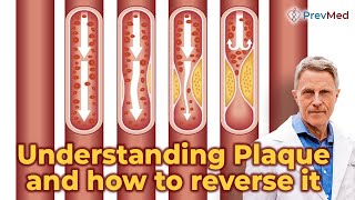 Understanding Plaque and how to reverse it [upl. by Mischa]