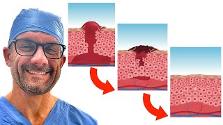 Wound Healing Simply Explained [upl. by Fernando]