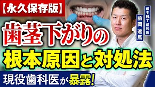 【暴露】歯茎下がりの本当の原因・治療法等を完全攻略【歯科医】 [upl. by Adriell]