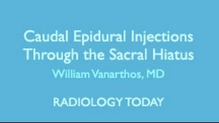 Caudal Epidural Injections and Hip Pain Imaging [upl. by Lemart]