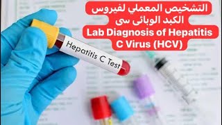 التشخيص المعملي لفيروس الكبد الوبائى سى Lab Diagnosis of Hepatitis C Virus HCV [upl. by Gitt]