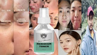 Jiore Meridiem Toner  Honest Review [upl. by Ennasil913]