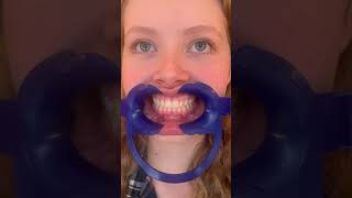 Dr Smith How to use your cheek retractors during a virtual appointment [upl. by Irab]