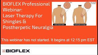 Laser Therapy For Shingles amp Postherpetic Neuralgia [upl. by Nicolea714]