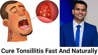 How To Cure Tonsillitis Fast And Naturally Powerful Home Remedies For Tonsil Stones That Works Fast [upl. by Rebmetpes]