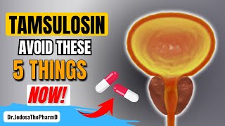 Taking Tamsulosin 5 Things You Must Avoid If You Are Taking Tamsulosin [upl. by Nerrot]