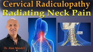 Cervical Radiculopathy Radiating Neck Pain  Dr Mandell Live Stream [upl. by Adebayo838]