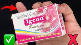 Igcon Cream Side Effects kaise thik kare  Fairness in 3 night [upl. by Baylor753]