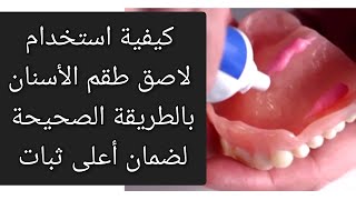 كيفية استخدام لاصق طقم الأسنان بالطريقة الصحيحة لضمان أعلى ثبات للطقم المتحركcolle prothèse dentaire [upl. by Neeloj]