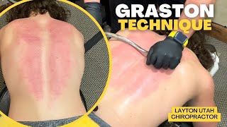 Graston Technique On Spine And Forearm  Layton Utah Chiropractor [upl. by Catharina]