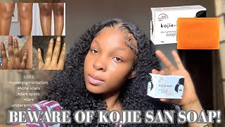 KOJIE SAN SOAP REVIEW USESBENEFITS HOW TO USE PROPERLY AND IDENTIFY THE FAKE AND ORIGINAL [upl. by Tawnya]