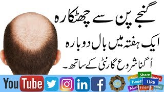 GanjaPan Ka Ilaj  Aik Hafte main GanjaPan ka ilaj  Hair loss Treatment  sar ke Naye Baal Ugana [upl. by Nosneh]