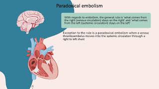 Paradoxical embolism [upl. by Nwahs138]