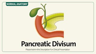 Linear EUS Pancreatic Divisum [upl. by Ived]