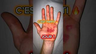 ÉVOLUTION BLESSURE en 40 JOURS ⚠️📈 shorts parkour gym [upl. by Utta]