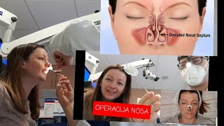 OPERACIJA NOSA [upl. by Mikol]