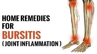 5 Remedies For Bursitis  How to Treat Bursitis  By Top 5 [upl. by Schonfeld]