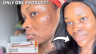 HOW TO ACHIEVE YOUR DREAM SKIN WITH TRETINOIN  How to use Tretinoin for beginners tretinoin [upl. by Forta]