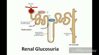 Renal glucosuria [upl. by Eelreveb]