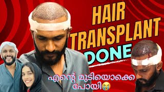 ✨അങ്ങനെ ഞാനും HAIR TRANSPLANT ചെയ്തു🥶Confidence onn Boooostaaakitind🤘🏻 [upl. by Gabey]