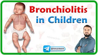 Bronchiolitis in Children  Etiology Clinical features Diagnosis Management and Complications [upl. by Enomahs]