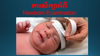 Newborn Examination [upl. by Nylyoj]