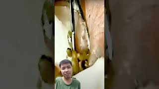 Big Cystic Acne Blackheads Extraction Blackheads amp Milia Whiteheads Removal Pimple Popping [upl. by Adolph]