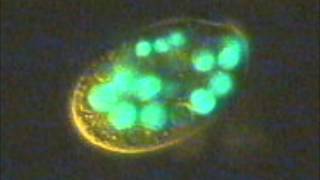 Ciliates eating fluorescent bacteria [upl. by Jarrell]