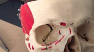 Cranial Nerves 6 of 12 Abducens Nerve  Head and Neck Anatomy 101 [upl. by Aida]